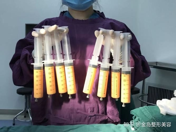 腹部赘肉抽脂：一种快速、有效的减肥方法(1)