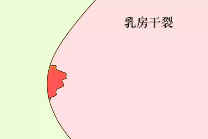 哺乳期瘦了好多正常吗？探讨哺乳期减肥的原因和方法(1)