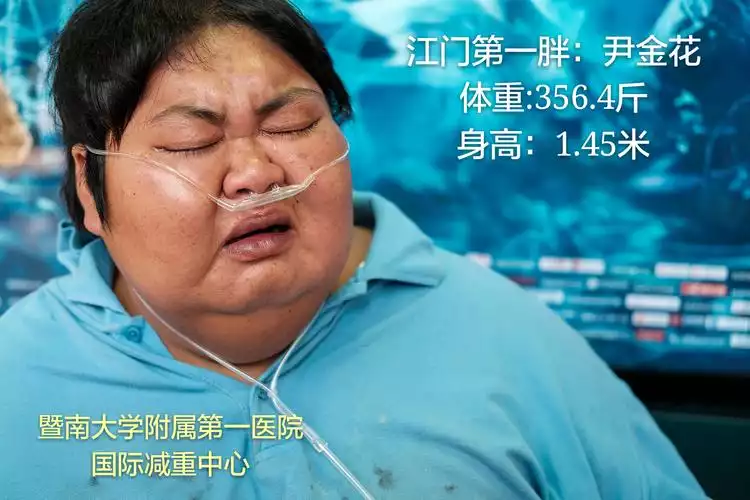 如何有效应对重度肥胖？——一位成功减肥者的经验分享(1)