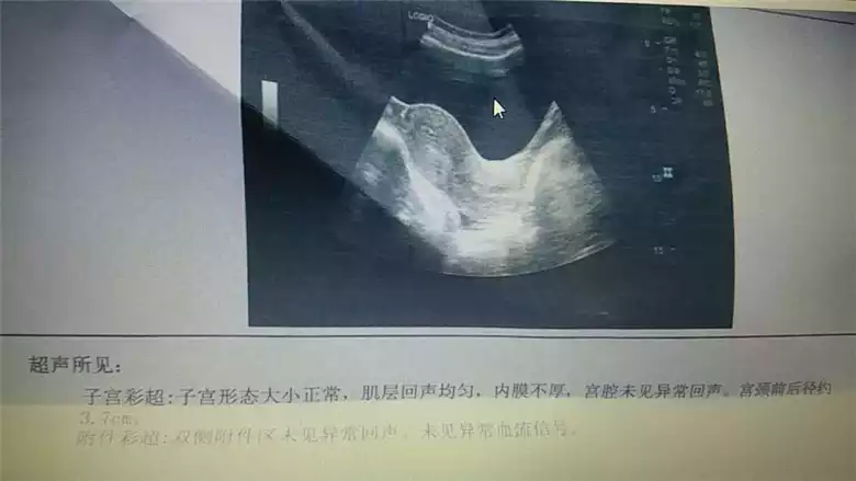 药流后多久可以开始运动减肥？如何科学减肥？(1)