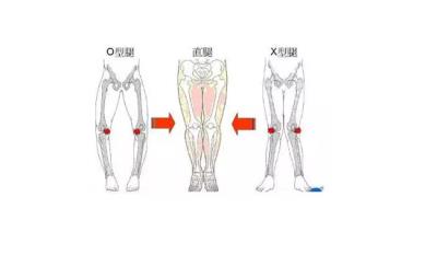 大腿粗的原因，教你针对性改善不同腿型 瘦腿 第1张
